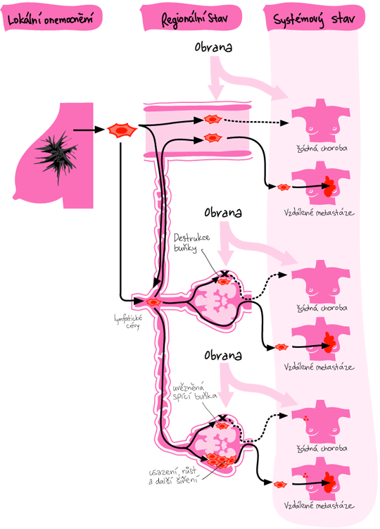 schema onemocneni